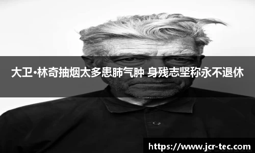 大卫·林奇抽烟太多患肺气肿 身残志坚称永不退休